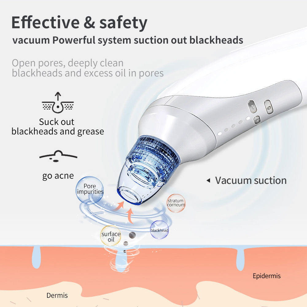 Pore Perfecting Blackhead Vacuum | Electric Skin Clearing Device